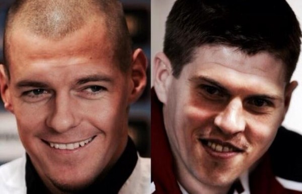 'Senin yüzüne ne olmuş?!