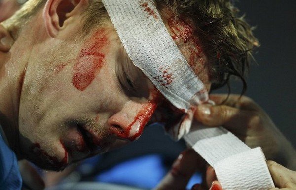 'Maçta bu hale geldiler!