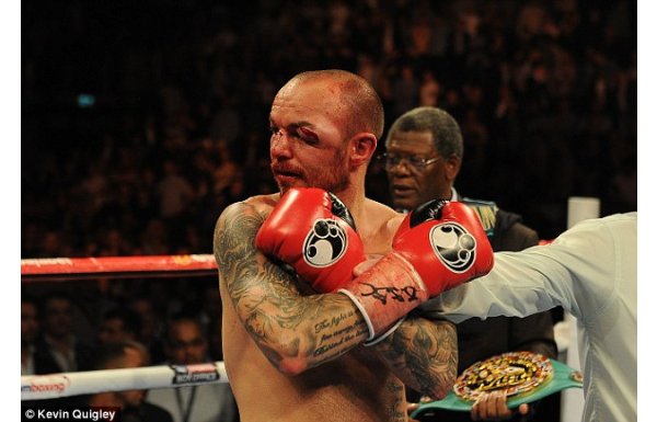 'Maçtan sonra bu hale geldi