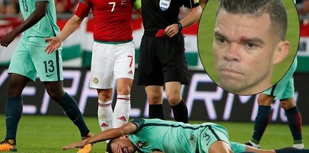Pepe’den özür dilettiler