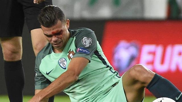 'Portekiz'de Pepe'ye dirsek! Kanlar içinde kaldı