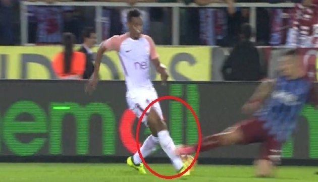 Bacağında 2 cm delik var