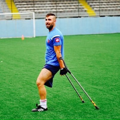 FEYYAZ GÖZAÇIK: Doğuştan sağ bacağı yok.