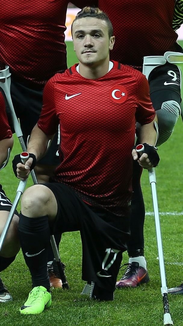 KEMAL GÜLEŞ: Şırnak’ta geçirdiği kazada ayağına taş düştü.