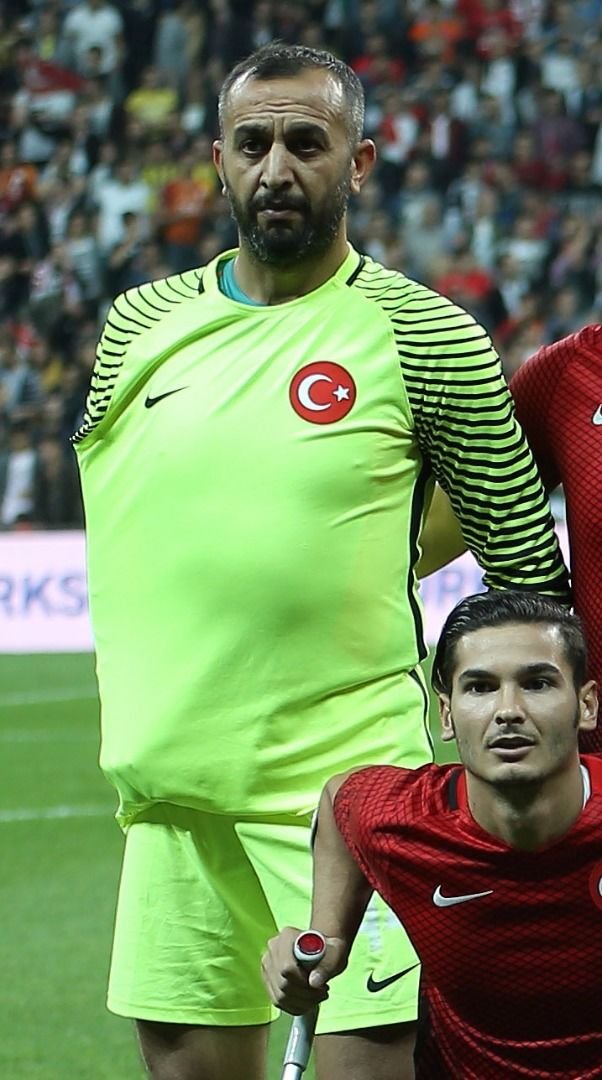 SELİM KARADAĞ: Doğuştan sağ kolu kısa.