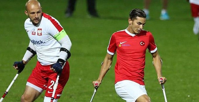 SERKAN DERELİ: Doğuştan sol ayağı yok.