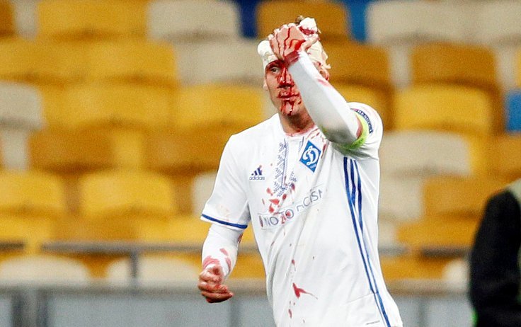 SEDYE BİLE İSTEMEDİ