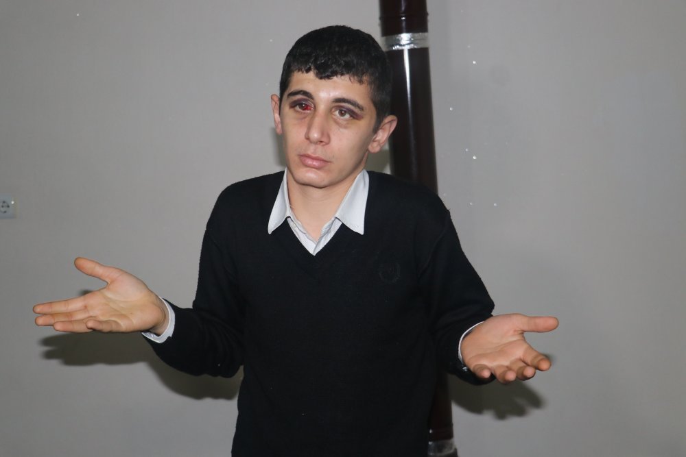 Beşiktaş'tan Adana'da saldırıya uğrayan işitme engelli gençle ilgili anlamlı hareket