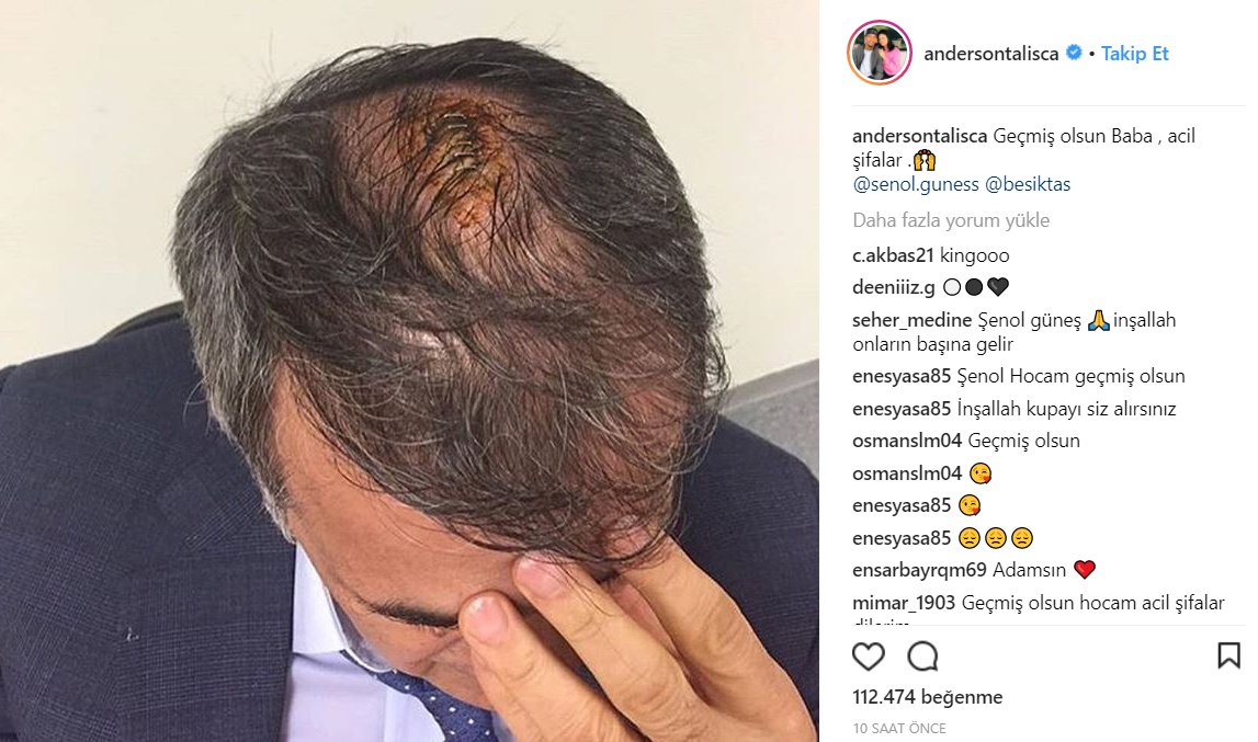 <h2>Anderson Talisca’dan Şenol Güneş paylaşımı</h2>