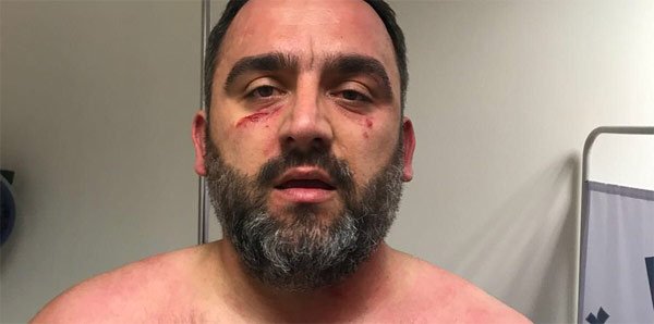 'Beşiktaşlı idareci Erdinç Gültekin'e neden saldırdılar?