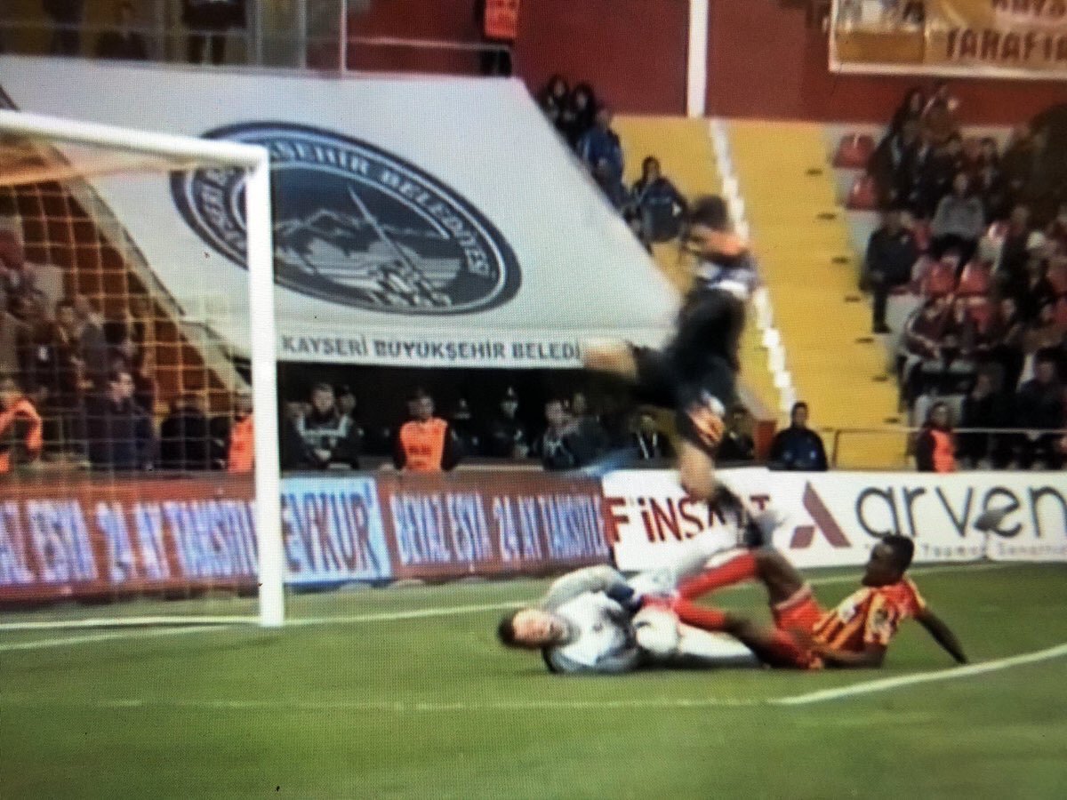 <h2>Kayseri’de Muslera şoku! Kafasına sahada dikiş atıldı</h2>