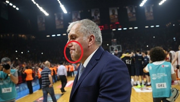 Fenerbahçe Haberleri: Galatasaray maçında Obradovic'in yüzüne ayran isabet etti