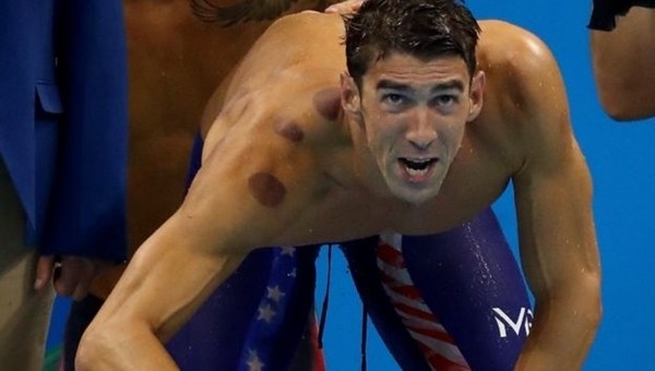 Rio'daki sporcuların lekelerinin sırrı ortaya çıktı