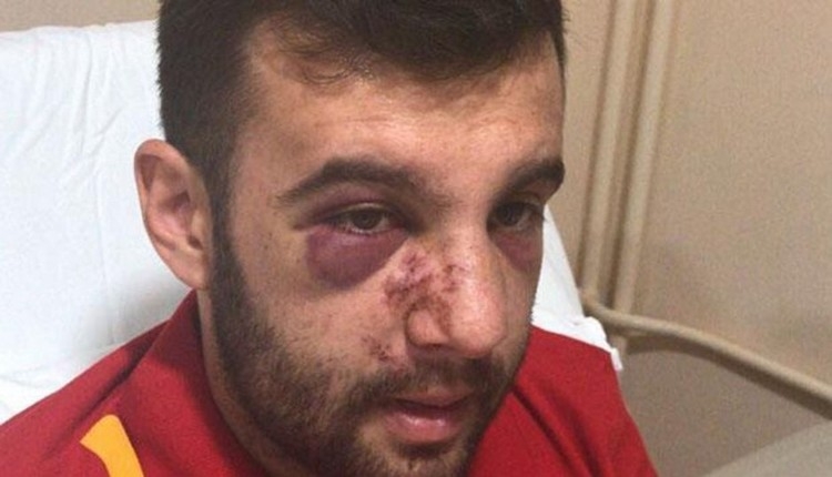 Galatasaraylı bir taraftara daha Konya'da saldırı