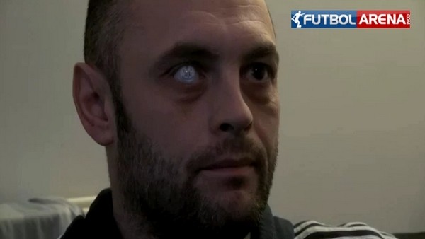 Gözüne tuttuğu takımın logosunu işletti!