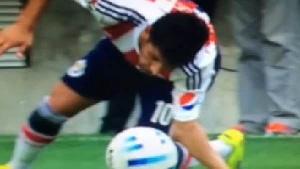 Öyle bir düştü ki, kolu kırıldı!