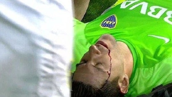 Yeşil Sahada Kan Döküldü!