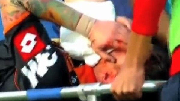 Golü attı, kanlar içinde yerde kaldı!