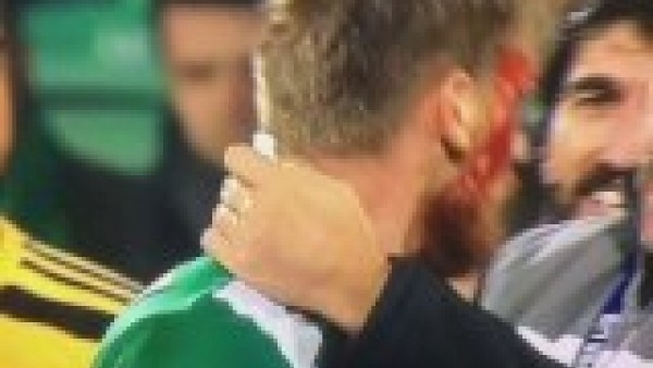 Serdar Aziz kanlar içinde kaldı!