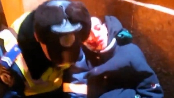 St. Etienne taraftarı ağır yaralandı!