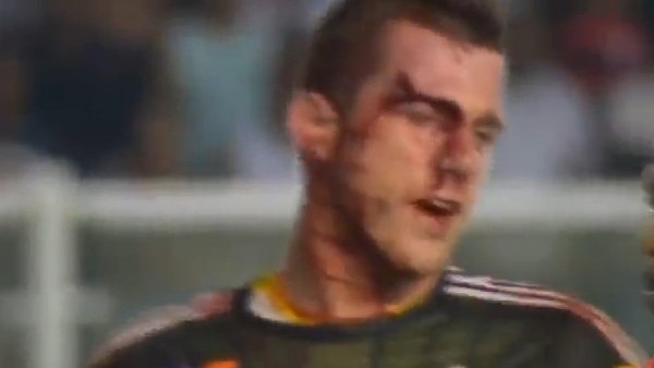 Kaleci kanlar içinde yerde kaldı!