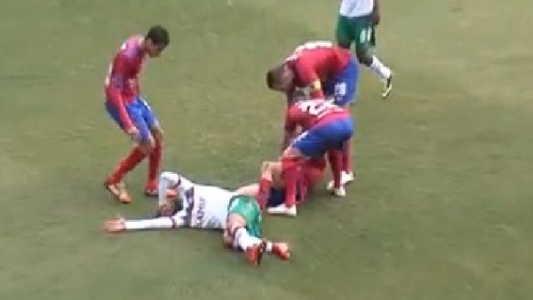 Yere ters bastı, bileği kırıldı!