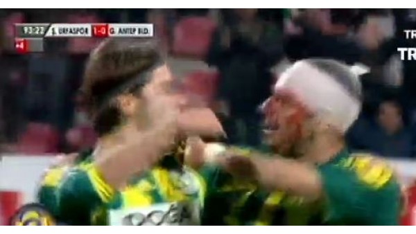 Yüzü gözü kanlar içinde golü attı