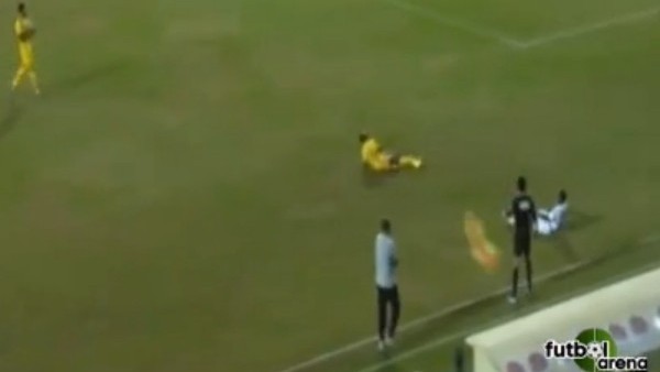 Böyle ayak kırılması görülmedi!