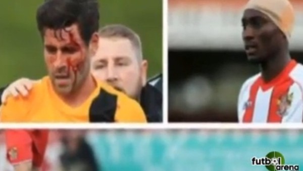 İngiltere'yi sallayan çarpışma! Hastanelik oldular...