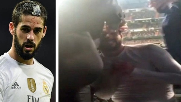 İsco'ya saha kenarında 9 dikiş