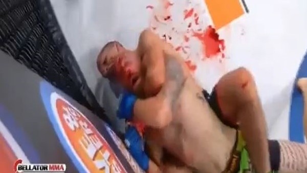 MMA'de tüyler ürperten görüntü