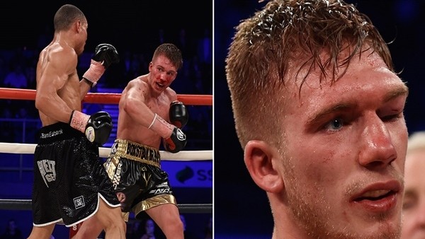 Yediği Feci Dayak Sonrası Beyin Kanaması Geçirdi!