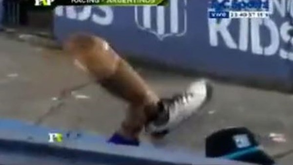 Çılgın Taraftar Protez Bacağını Çıkartara Sevindi