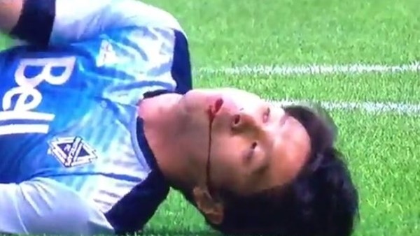 Rumen futbolcu ili boğazına kaçan oyuncuyu kurtardı