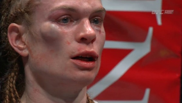 Yediği dayak bu hale getirdi