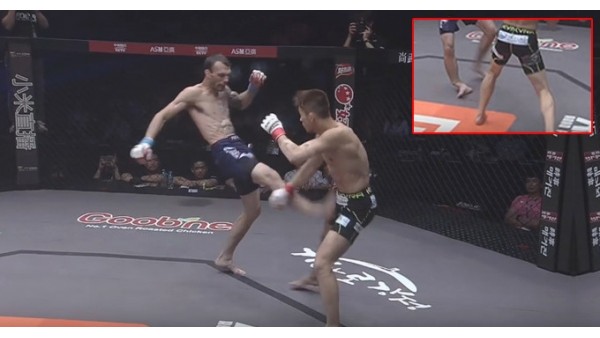 Rakibine tekme attı bacağı kırıldı