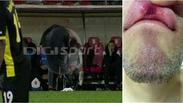 Romanya'nın Yılmaz Vural'ı oyuncusunun dudağını patlattı