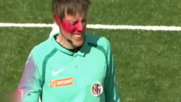 Yan hakem hayatının şokunu yaşadı!