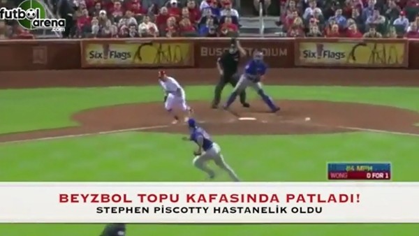 Beyzbol topu kafasında patladı!