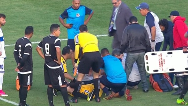 Brezilya'da hakemin ayağı kırıldı