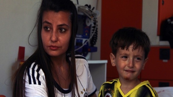 Fenerbahçe antrenmanında görünmez kaza