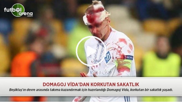 Domagoj Vida'dan korkutan sakatlık