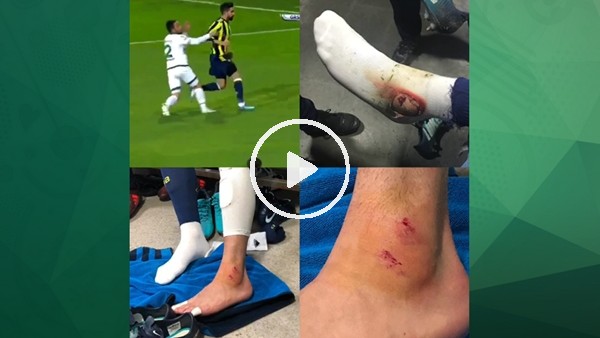 Giresunspor maçında sakatlanan Hasan Ali Kaldırım'ın bileği